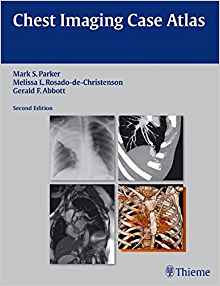 (eBook PDF)Chest Imaging Case Atlas, 2nd Edition by Mark S. Parker