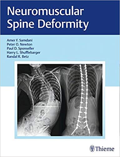 (eBook PDF)Neuromuscular Spine Deformity by Amer Samdani , Peter O. Newton , Paul Sponseller , Harry L. Shufflebarger , Randal R. Betz 