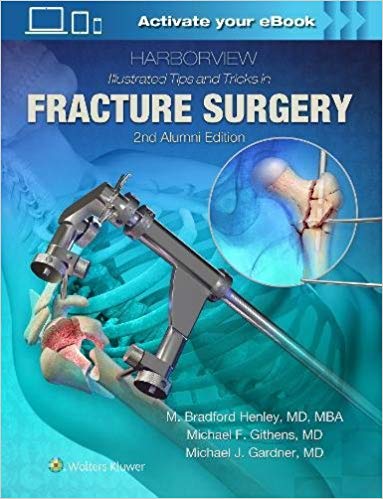 (eBook PDF)Harborview Illustrated Tips and Tricks in Fracture Surgery, 2nd Alumni Edition by M. Henley MD 