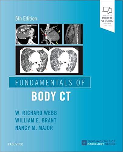 (eBook PDF)Fundamentals of Body CT (Fundamentals of Radiology) 5th Edition by W. Richard Webb MD , Wiliam E. Brant MD FACR , Nancy M. Major MD 