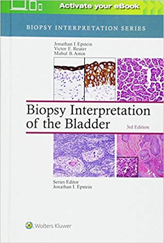 (eBook PDF)Biopsy Interpretation of the Bladder 3rd Edition by Jonathan Epstein MD , Victor Reuter MD , Mahul B. Amin