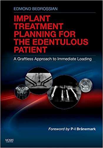 (eBook PDF)Implant Treatment Planning for the Edentulous Patient by Edmond Bedrossian DDS FACD FACOMS