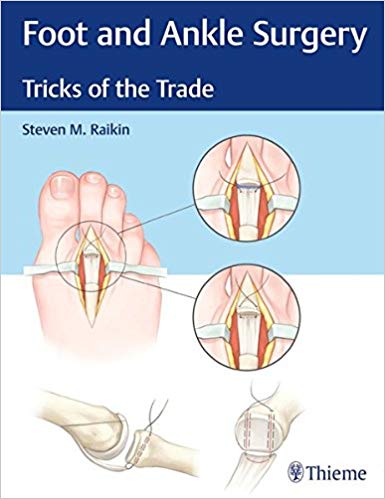 (eBook PDF)Foot and Ankle Surgery Tricks of the Trade by Steven Raikin 