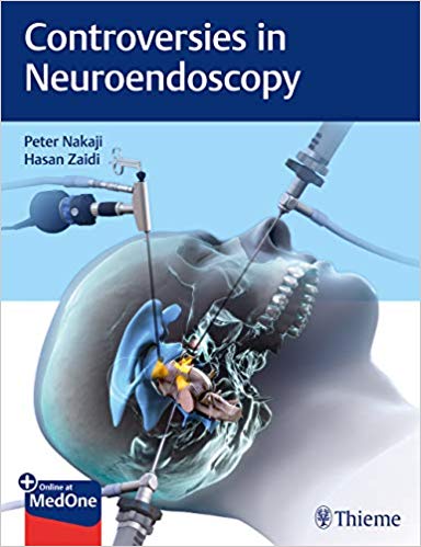 (eBook PDF)Controversies in Neuroendoscopy by Peter Nakaji , Hasan A. Zaidi 