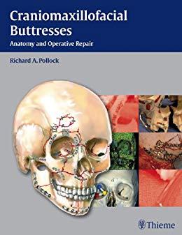 (eBook PDF)Craniomaxillofacial Buttresses by Richard Pollock , Richard A. Pollock 