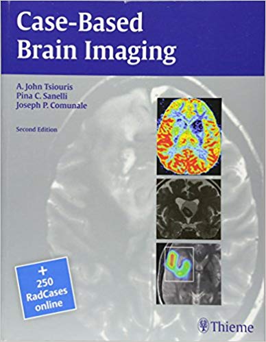 (eBook PDF)Case-Based Brain Imaging, 2nd Edition, 2013 by Apostolos John Tsiouris , Pina C. Sanelli , Joseph Comunale 