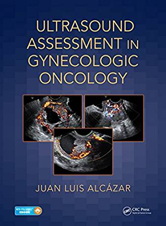 (eBook PDF)Ultrasound Assessment in Gynecologic Oncology