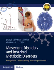 (eBook PDF)Movement Disorders and Inherited Metabolic Disorders: Recognition, Understanding, Improving Outcomes 1st Edition