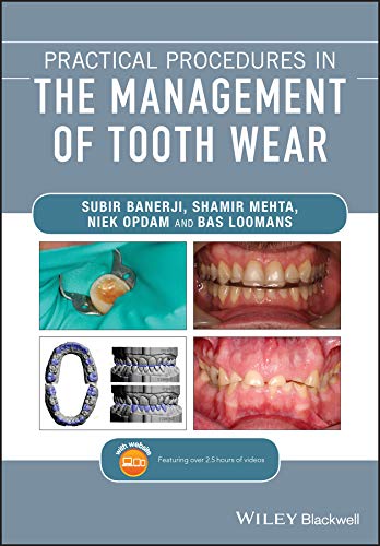 (eBook PDF)Practical Procedures in the Management of Tooth Wear by Subir Banerji , Shamir B. Mehta , Niek Opdam , Bas Loomans 