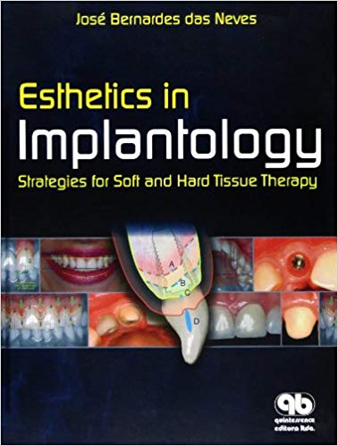 (eBook PDF)Esthetics in Implantology by Jose Bernardes das Neves 
