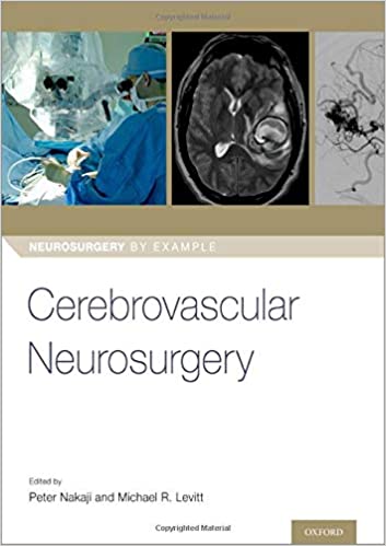 (eBook PDF)Cerebrovascular Neurosurgery (Neurosurgery by Example)