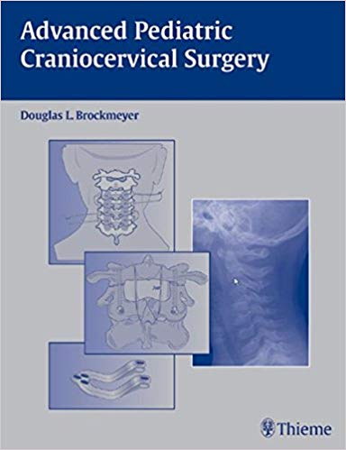 (eBook PDF)Advanced Pediatric Craniocervical Surgery by Douglas L. Brockmeyer 