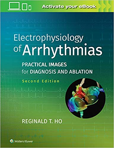 (eBook PDF)Electrophysiology of Arrhythmias: Practical Images for Diagnosis and Ablation Second Edition by Ho MD, Reginald T. 