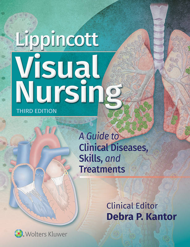 (eBook PDF)Lippincott Visual Nursing: A Guide to Clinical Diseases, Skills, and Treatments 3rd Edition