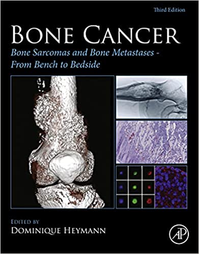 (eBook PDF)Bone Cancer: Bone Sarcomas and Bone Metastases - From Bench to Bedside 3rd Edition by Dominique Heymann