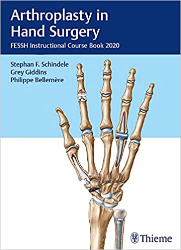 (eBook PDF)Arthroplasty in Hand Surgery by Stephan F. Schindele,Grey Giddins,Philippe Bellemère