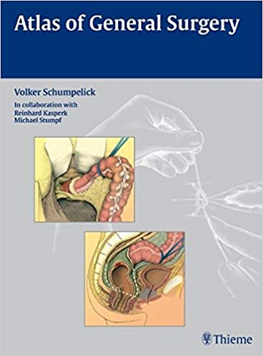 (eBook PDF)Atlas of General Surgery by Volker Schumpelick 