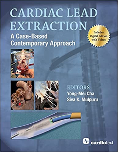 (eBook PDF)Cardiac Lead Extraction A Case-Based Contemporary Approach by Yong-Mei Cha , Siva K. Mulpuru 