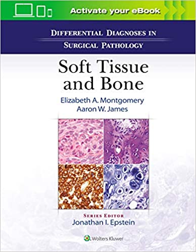 (eBook HTML)Differential Diagnoses in Surgical Pathology Soft Tissue and Bone by Elizabeth A. Montgomery MD , Aaron James MD PhD 