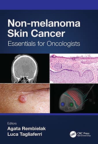 (eBook PDF)Non-melanoma Skin Cancer Essentials for Oncologists by Agata Rembielak,Luca Tagliaferri