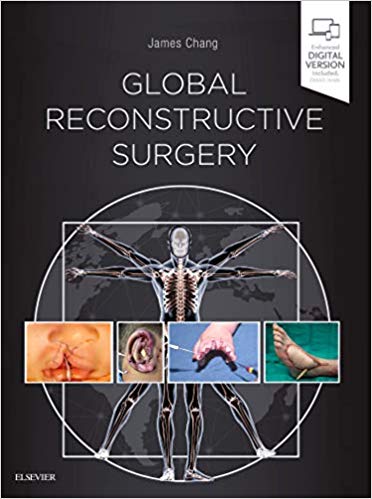 (eBook PDF)Global Reconstructive Surgery by James Chang MD 