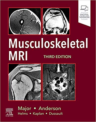 (eBook PDF)Musculoskeletal MRI, Third Edition by Nancy M. Major , Mark W. Anderson 