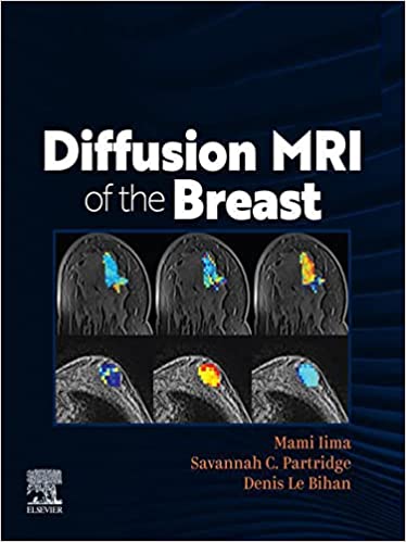 (eBook PDF)Diffusion MRI of the Breast 1st Edition by Mami Iima,Savannah Partridge,Denis Le Bihan