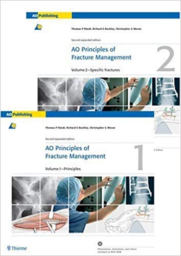 (eBook PDF)AO Principles of Fracture Management, 2nd Expanded Edition by Thomas P. Ruedi,Thomas Ruedi