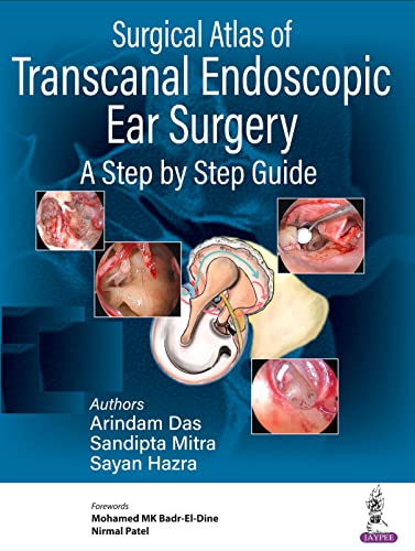 (eBook PDF)Surgical Atlas of Transcanal Endoscopic Ear Surgery A Step by Arindam Das,Sandipta Mitra,Sayan Hazra