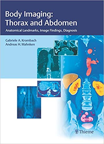 (eBook PDF)Body Imaging: Thorax and Abdomen  by Gabriele A. Krombach , Andreas H. Mahnken 