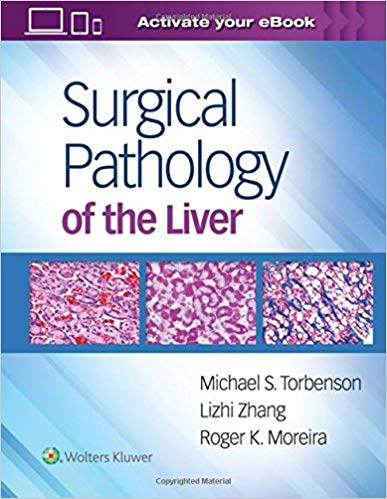 (eBook PDF)Surgical Pathology of the Liver +EPUB版 by Michael Torbenson MD , Roger Moreira MD , Lizhi Zhang MD 