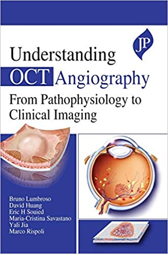 (eBook PDF)Understanding OCT Angiography From Pathophysiology to Clinical Imaging by Bruno Lumbroso , David Huang , Eric H Souied , Cristina Maria Savastano 