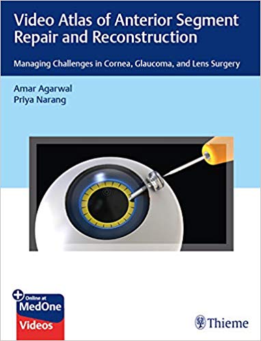 (eBook PDF)Video Atlas of Anterior Segment Repair and Reconstruction PDF by Amar Agarwal , Priya Narang 