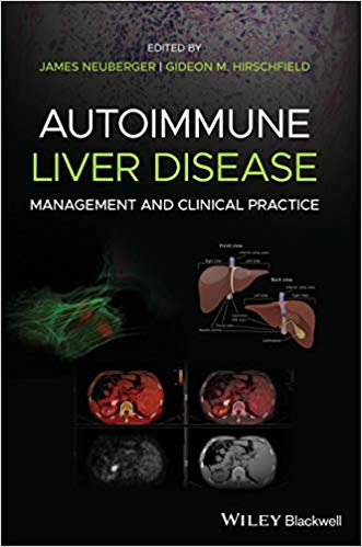 (eBook PDF)Autoimmune Liver Disease Management and Clinical Practice by James Neuberger , Gideon M. Hirschfield 