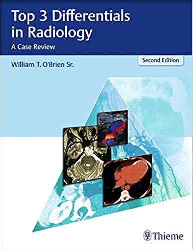 (eBook PDF)Top 3 Differentials in Radiology: A Case Review 2nd Edition by William T. O Brien 