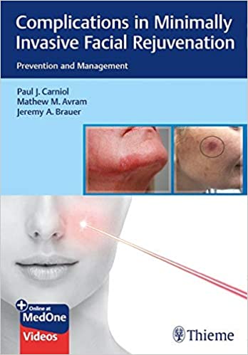 (eBook PDF)Complications in Minimally Invasive Facial Rejuvenation: Prevention and Management PDF+VIDEOS by Paul Carniol , Mathew M. Avram , Jeremy A. Brauer 