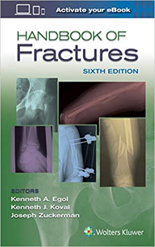 (eBook PDF)Handbook of Fractures, 5th Edition by Egol 