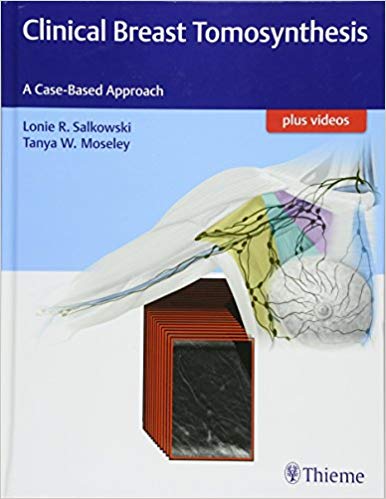 (eBook PDF)Clinical Breast Tomosynthesis (包含视频) by Lonie R. Salkowski , Tanya Moseley 