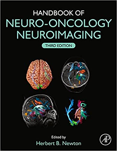 (eBook PDF)Handbook of Neuro-Oncology Neuroimaging (3rd Editon) by Herbert B. Newton 