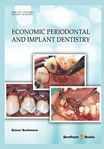 (eBook PDF)Economic Periodontal and Implant Dentistry by Rainer Buchmann 