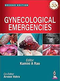 (eBook PDF)Gynecological Emergencies 2nd Edition by Kamini A Rao , Arveen Vohra 