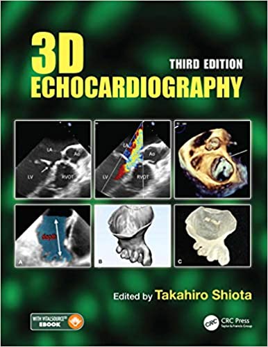 (eBook PDF)3D Echocardiography 3rd Edition by Takahiro Shiota