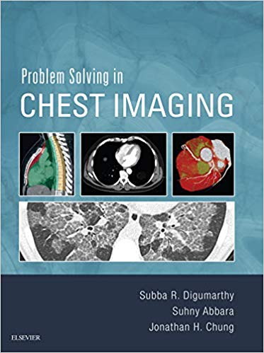 (eBook PDF)Problem Solving in Chest Imaging by Subba R. Digumarthy , Suhny Abbara , Jonathan H. Chung 