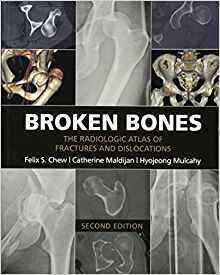 (eBook PDF)Broken Bones - The Radiologic Atlas of Fractures and Dislocations 2nd Edition by Felix S. Chew , Catherine Maldijan , Hyojeong Mulcahy 