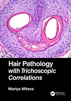 (eBook PDF)Hair Pathology with Trichoscopic Correlations by Mariya Miteva