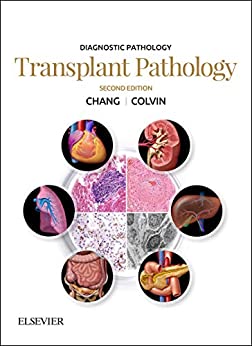(eBook PDF)Diagnostic Pathology Transplant Pathology E-Book 2nd Edition by Anthony C. Chang , Matthew R Lindberg 