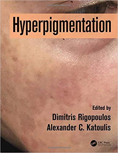 (eBook PDF)Hyperpigmentation by Dimitris Rigopoulos , Alexander C. Katoulis 