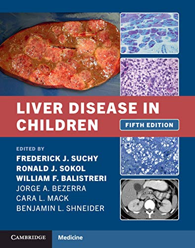 (eBook PDF)Liver Disease in Children 5th Edition by Frederick J. Suchy , Ronald J. Sokol , William F. Balistreri 