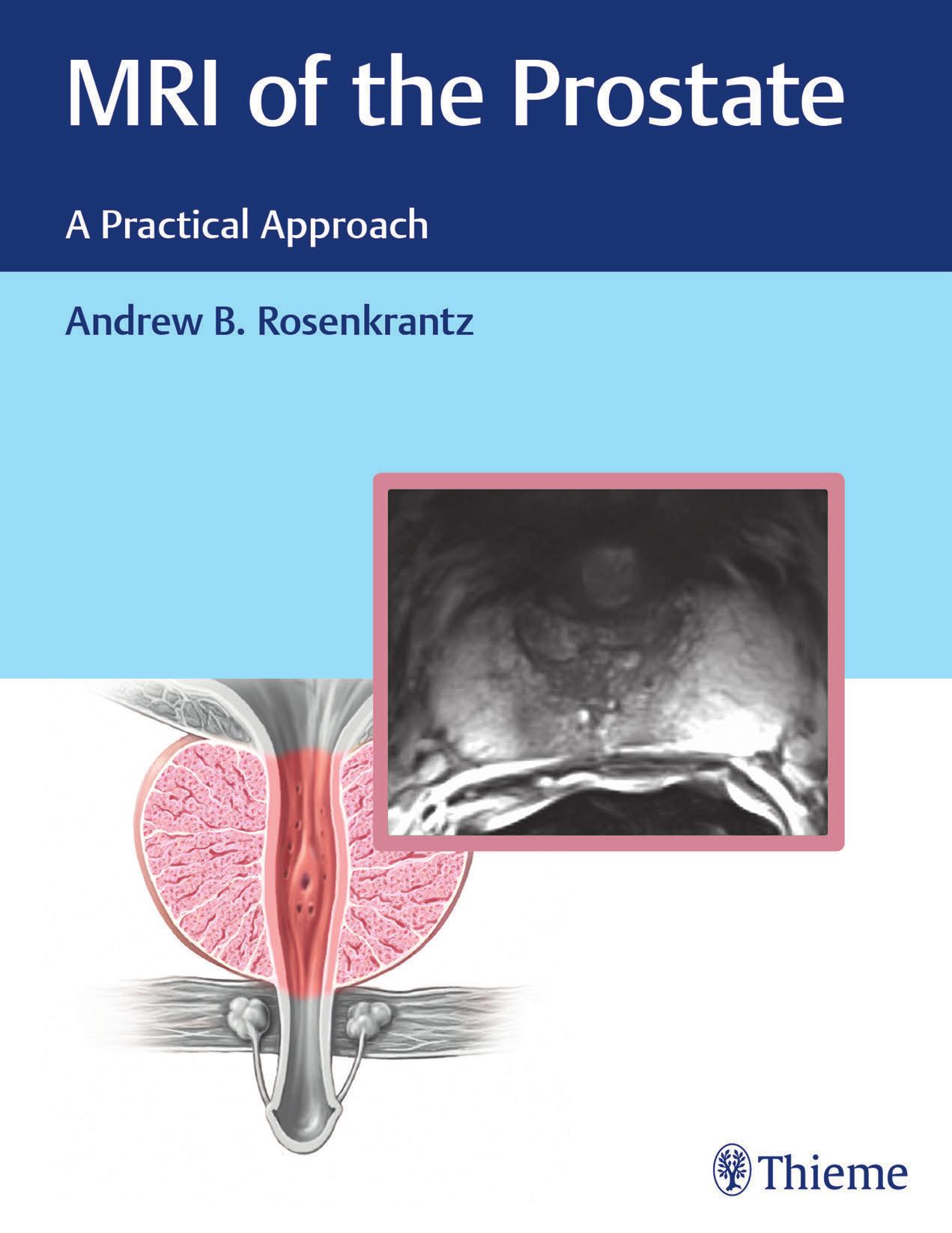 (eBook PDF)MRI of the Prostate_ A Practical Approach by Andrew B. Rosenkrantz