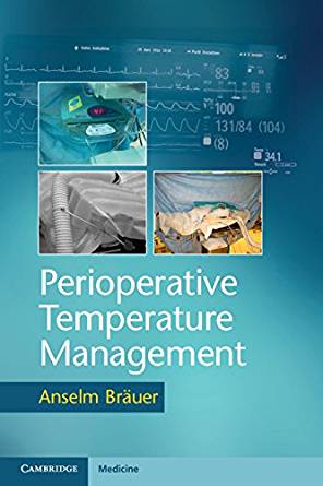 (eBook PDF)Perioperative Temperature Management by Anselm Bräuer 